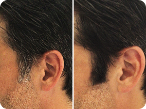 Vues rapprochées de la coiffure d'une personne coiffée avec des accessoires pour cheveux en tissu brun clair, montrant différents angles de pinces en forme de nœud et de rose.