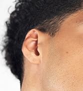 Vue latérale rapprochée d'une oreille humaine et de la peau environnante, montrant une partie de la mâchoire et des cheveux