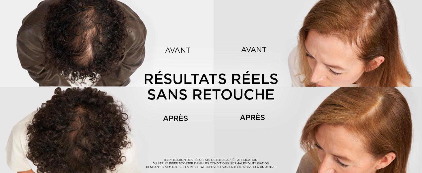 L'Oréal Paris Elseve Fiber Booster Shampooing Anti-Chute 200ml